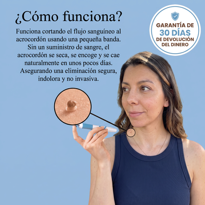 Kit para eliminar acrocordones sin dolor